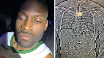 Jaythan Lawrence Gilder, 32, of Houston, Texas, is accused of stealing nearly $800,000 worth of jewelry from a Tiffany & Co. store in Orlando, Florida, and then swallowing the evidence. Jaythan Lawrence Gilder and body scan